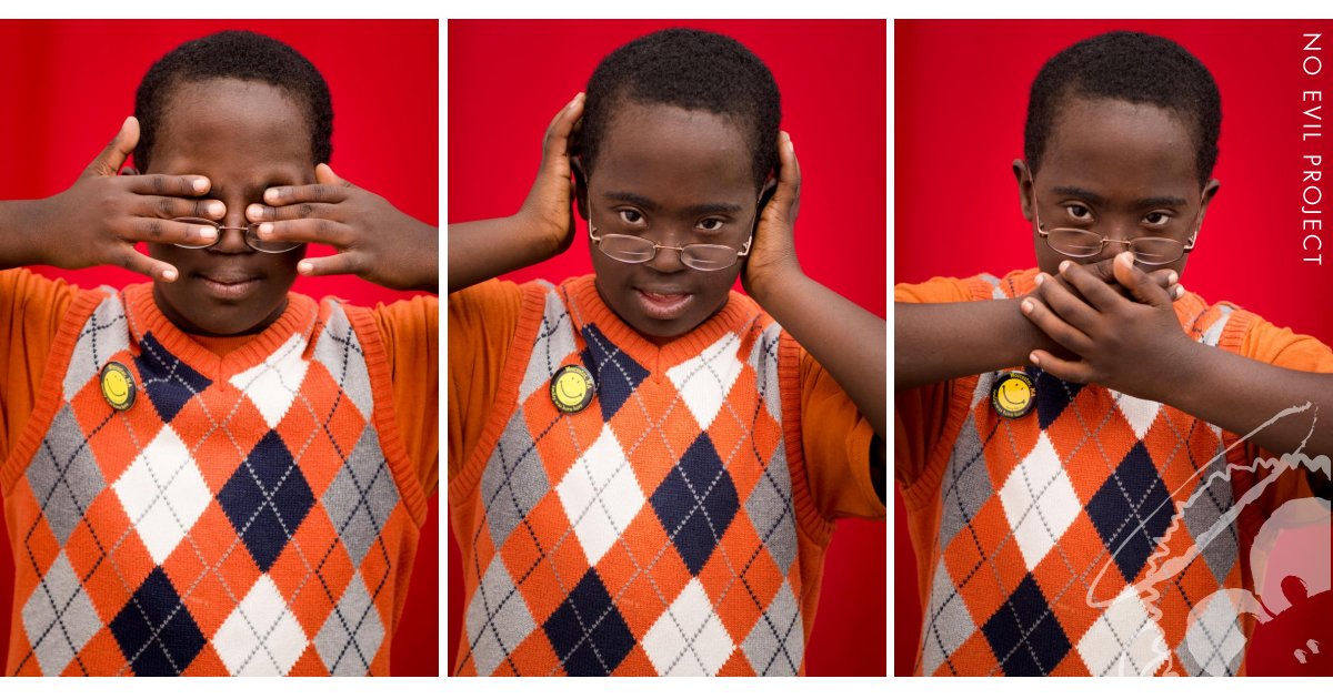 James: Adopted, Kenyan, Down Syndrome - I raise money every year for congenital heart defects research.